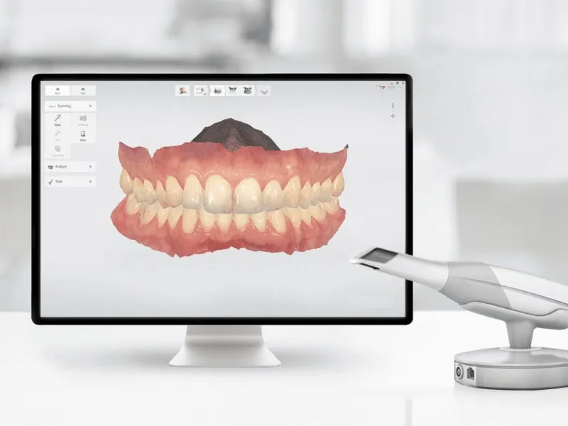 Escáner intraoral 3D