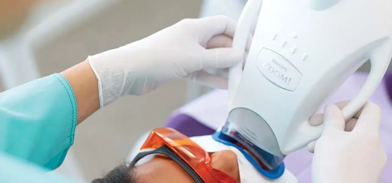Blanqueamiento dental